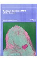 Contrast-enhanced M.R.I.of the Breast