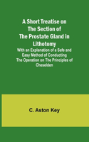 Short Treatise on the Section of the Prostate Gland in Lithotomy;With an Explanation of a Safe and Easy Method of Conducting the Operation on the Principles of Cheselden