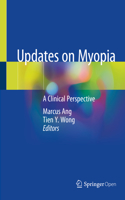 Updates on Myopia