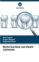 Nicht-kariöse zervikale Läsionen