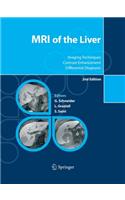 MRI of the Liver
