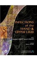 Infections of the Hand & Upper Limb