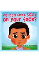 Why do you have a scar on your face?