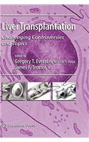 Liver Transplantation