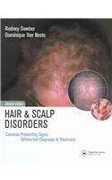 Hair and Scalp Disorders