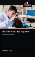 Guasti dentali dell'impianto