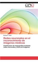Redes Neuronales En El Reconocimiento de Imagenes Medicas