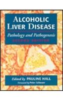 ALCOHOLIC LIVER DISEASE 2ED