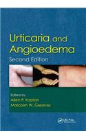 Urticaria and Angioedema