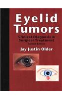 Eyelid Tumors