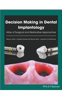 Decision Making in Dental Implantology