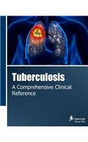 Tuberculosis