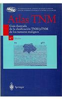 Atlas Tnm