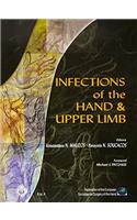 Infections Of The Hand And Upper Limb....