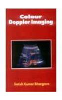 Colour Doppler Imaging