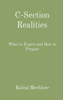 C-Section Realities