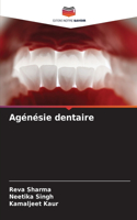 Agénésie dentaire