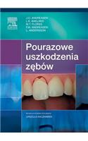 Pourazowe Uszkodzenia Z&#281;bów, Wyd. II