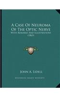 A Case Of Neuroma Of The Optic Nerve