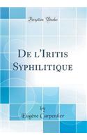 de l'Iritis Syphilitique (Classic Reprint)