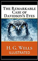 The Remarkable Case of Davidson's Eyes Illustrated