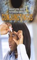 What You Need to Know About Conjunctivitis