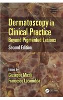 Dermatoscopy in Clinical Practice