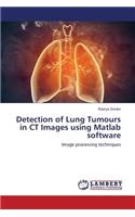 Detection of Lung Tumours in CT Images using Matlab software