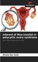 Interest of Myo-inositol in polycystic ovary syndrome