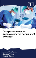 Гетеротопическая беременность: ????? ?? 3 ???????