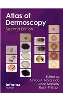 An Atlas of Dermoscopy