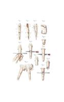 Disarticulation of Phalanges and Finger Composition Notebook