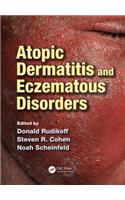 Atopic Dermatitis and Eczematous Disorders