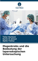 Magenkrebs und die Bedeutung der laparoskopischen Untersuchung