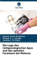 Lage des röntgenologischen Apex und des apikalen Foramens bei Molaren