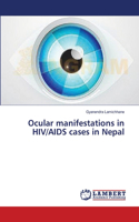 Ocular manifestations in HIV/AIDS cases in Nepal