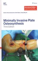MINIMALLY INVASIVE PLATE OSTEOSYNTHESIS