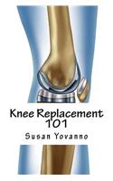 Knee Replacement 101