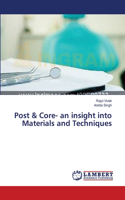 Post & Core- an insight into Materials and Techniques