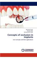 Concepts of occlusion in Implants