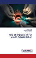 Role of Implants in Full Mouth Rehabilitation