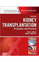 Kidney Transplantation with Access Code: Principles and Practice