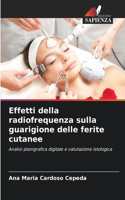 Effetti della radiofrequenza sulla guarigione delle ferite cutanee