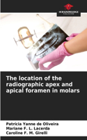 location of the radiographic apex and apical foramen in molars