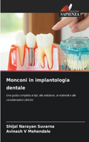 Monconi in implantologia dentale