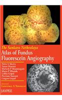 Atlas of Fundus Fluorescein Angiography