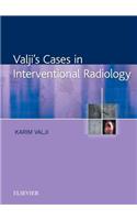 Valji's Cases in Interventional Radiology