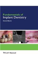 Fundamentals of Implant Dentistry
