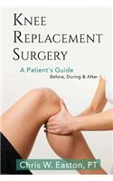 Knee Replacement Surgery, A Patient's Guide