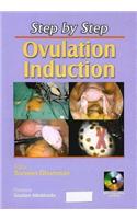 Step by Step: Ovulation Induction